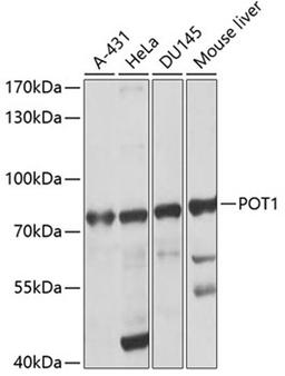 Western blot - POT1 antibody (A1491)