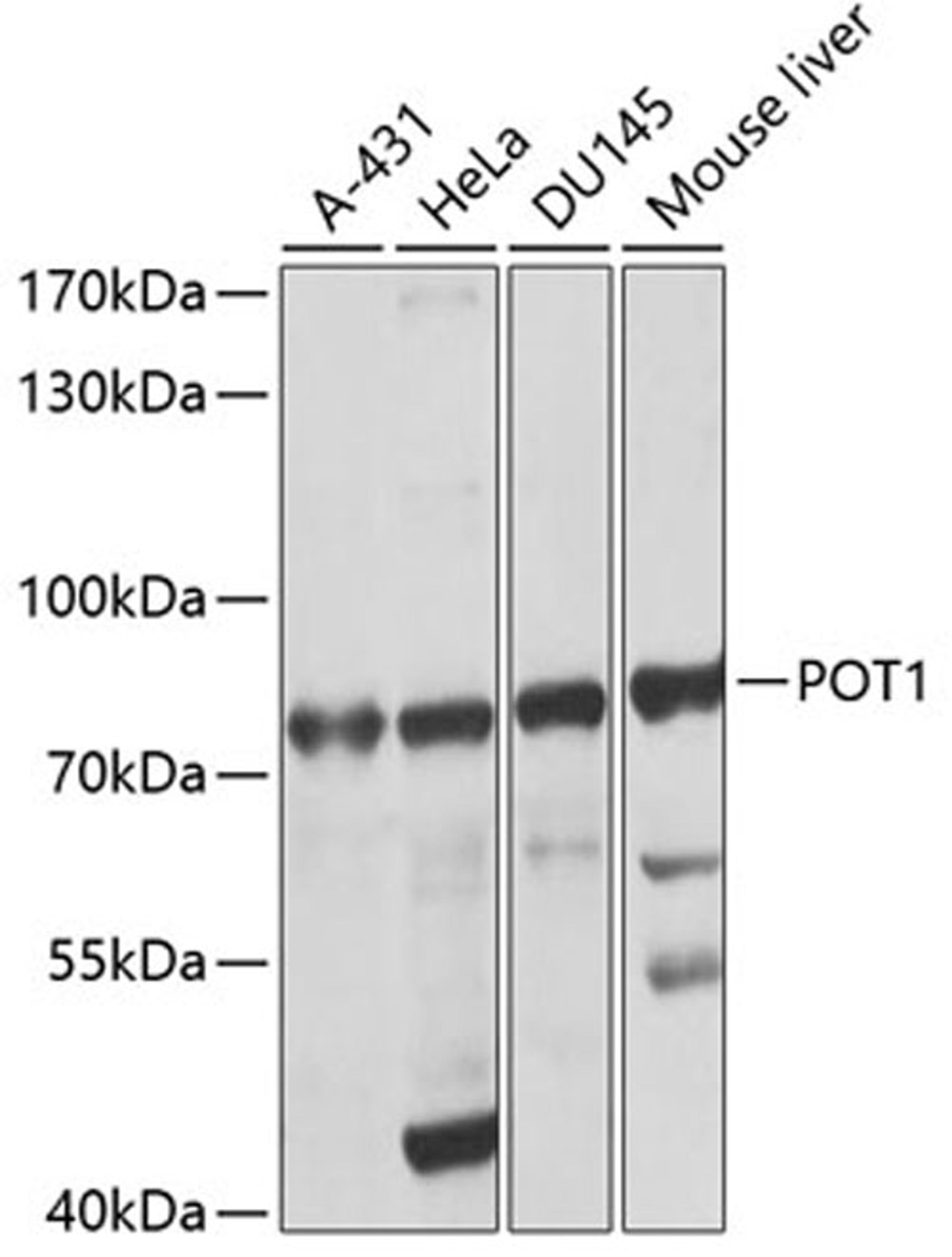 Western blot - POT1 antibody (A1491)