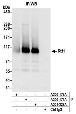 Detection of human Rtf1 by western blot of immunoprecipitates.