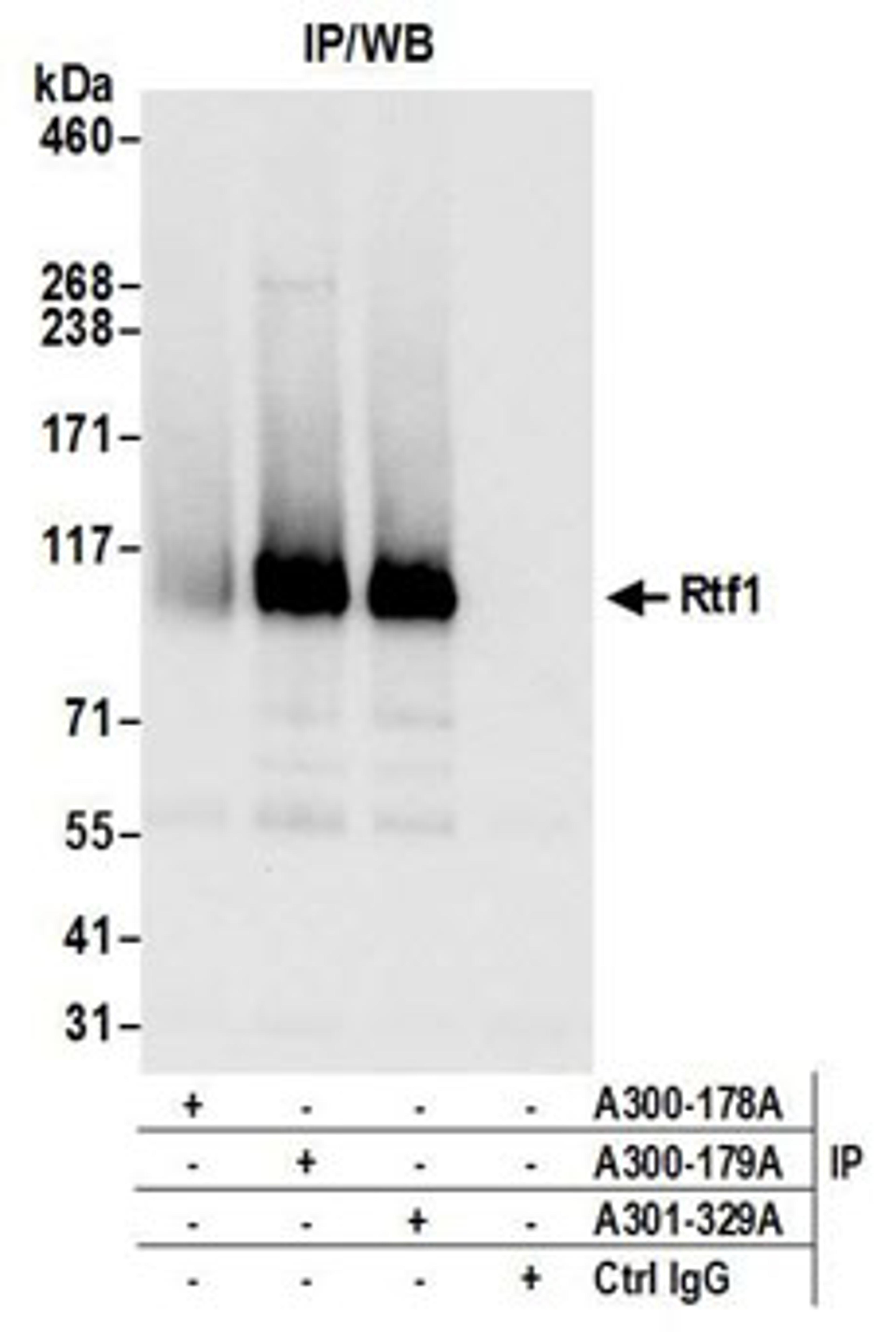 Detection of human Rtf1 by western blot of immunoprecipitates.