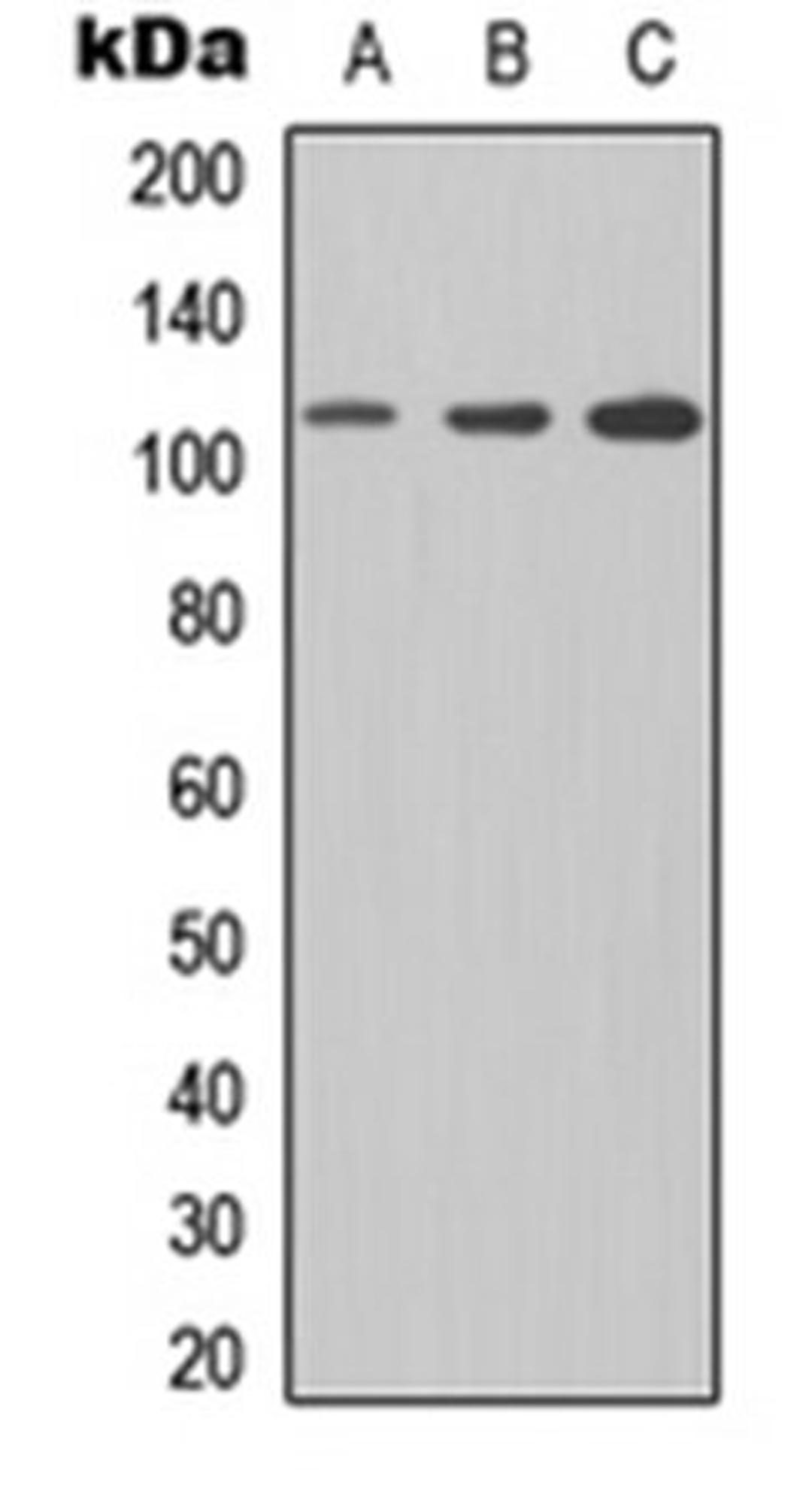 Western blot analysis of Jurkat (Lane1), NS-1 (Lane2), PC12 (Lane3) whole cell using CD307e antibody