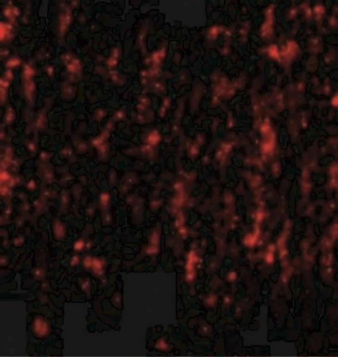 Immunocytochemistry/Immunofluorescence: SATB2 Antibody [NBP1-76912] - Immunofluorescence of SATB2 in Human Brain cells with SATB2 antibody at 20 ug/mL.