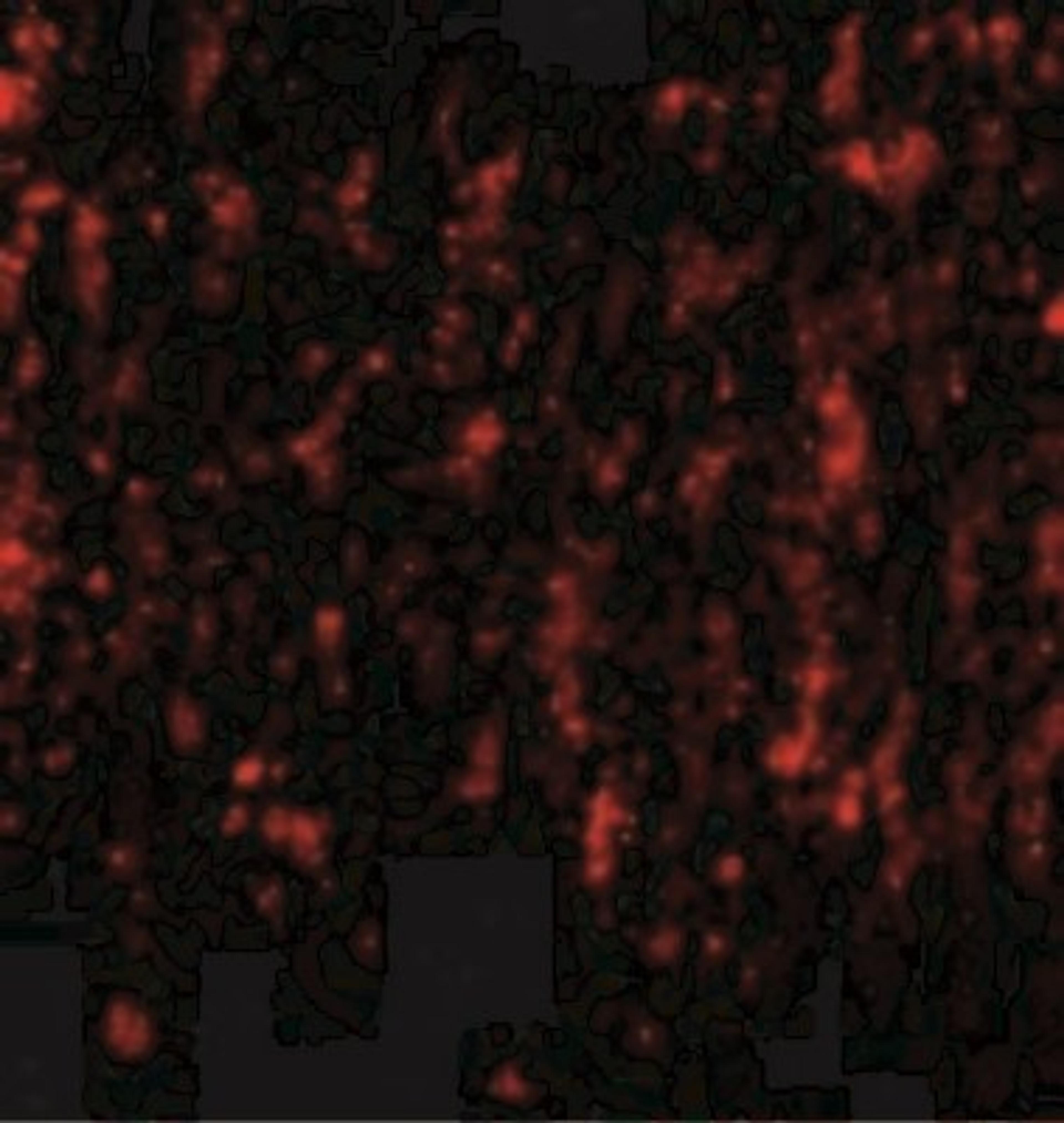 Immunocytochemistry/Immunofluorescence: SATB2 Antibody [NBP1-76912] - Immunofluorescence of SATB2 in Human Brain cells with SATB2 antibody at 20 ug/mL.