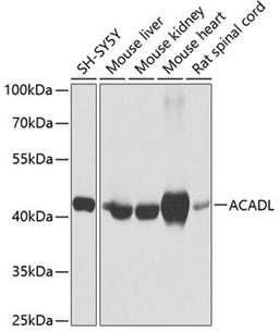 Western blot - ACADL antibody (A1266)