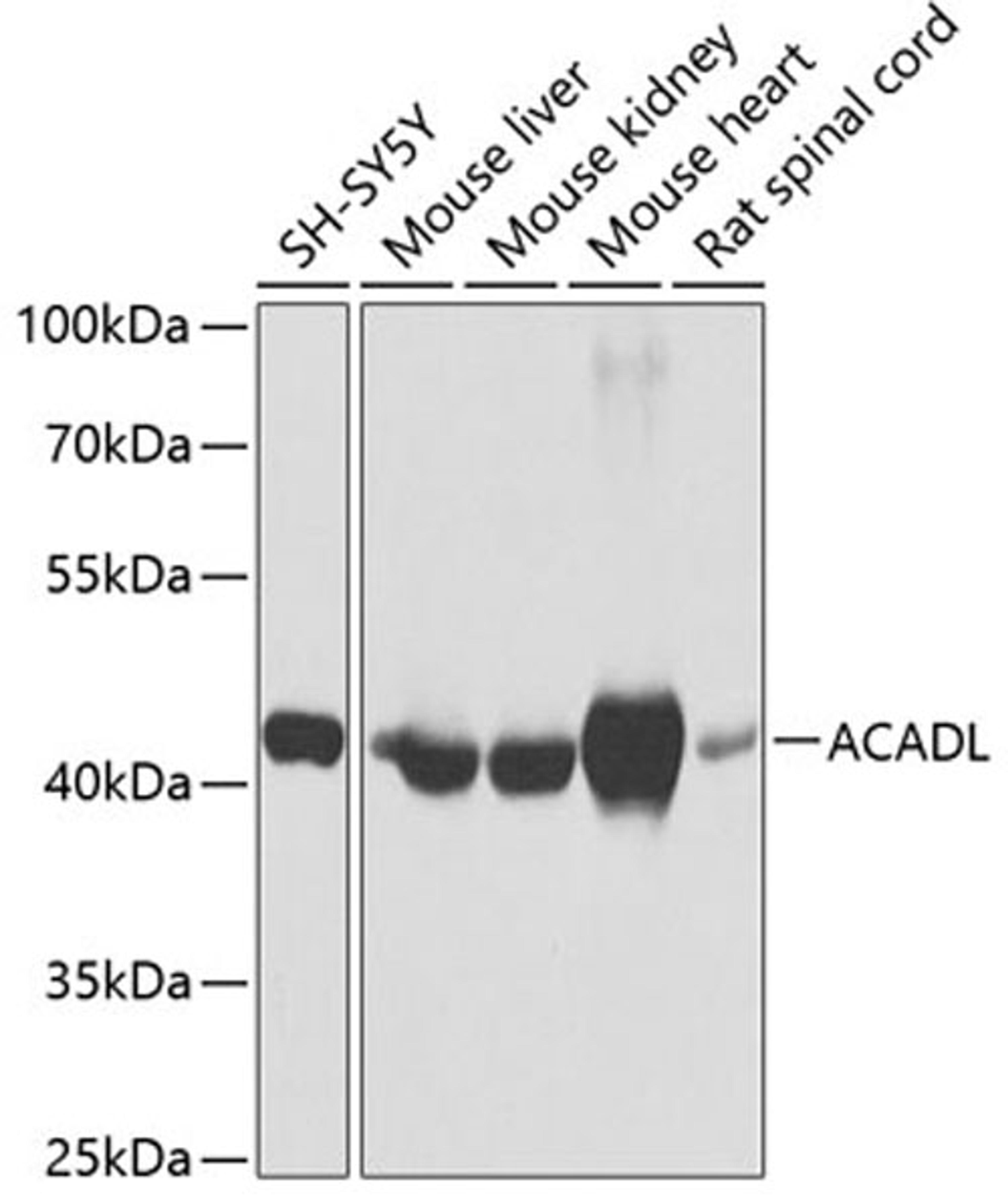 Western blot - ACADL antibody (A1266)