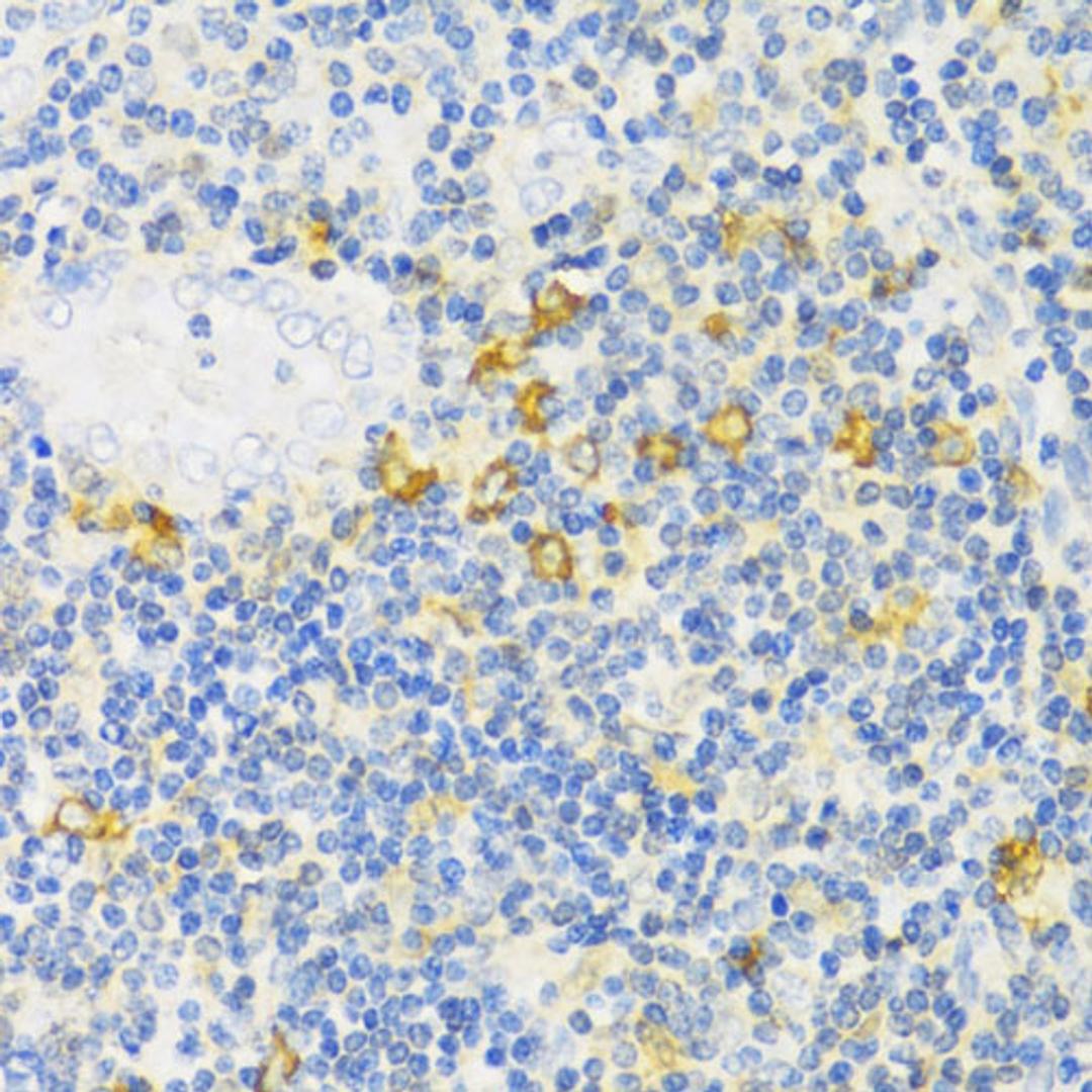 Immunohistochemistry - MLKL antibody (A13452)