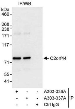 Detection of human C2orf44 by western blot of immunoprecipitates.