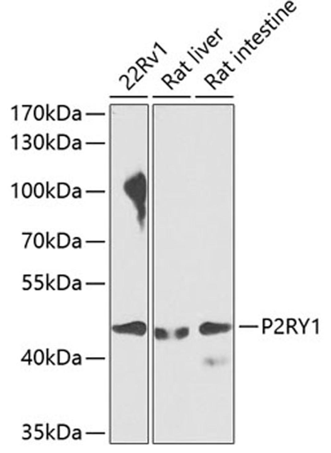 Western blot - P2RY1 antibody (A7706)