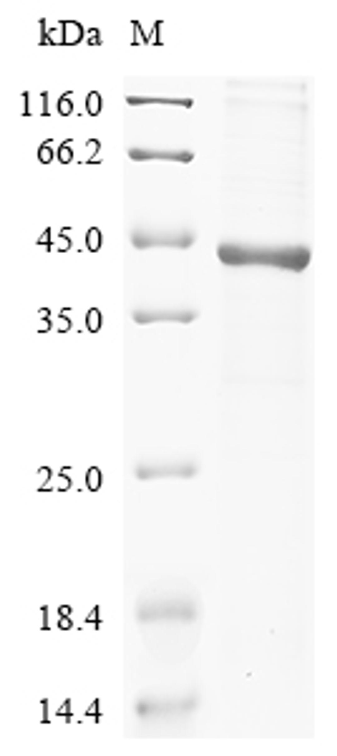 (Tris-Glycine gel) Discontinuous SDS-PAGE (reduced) with 5% enrichment gel and 15% separation gel.