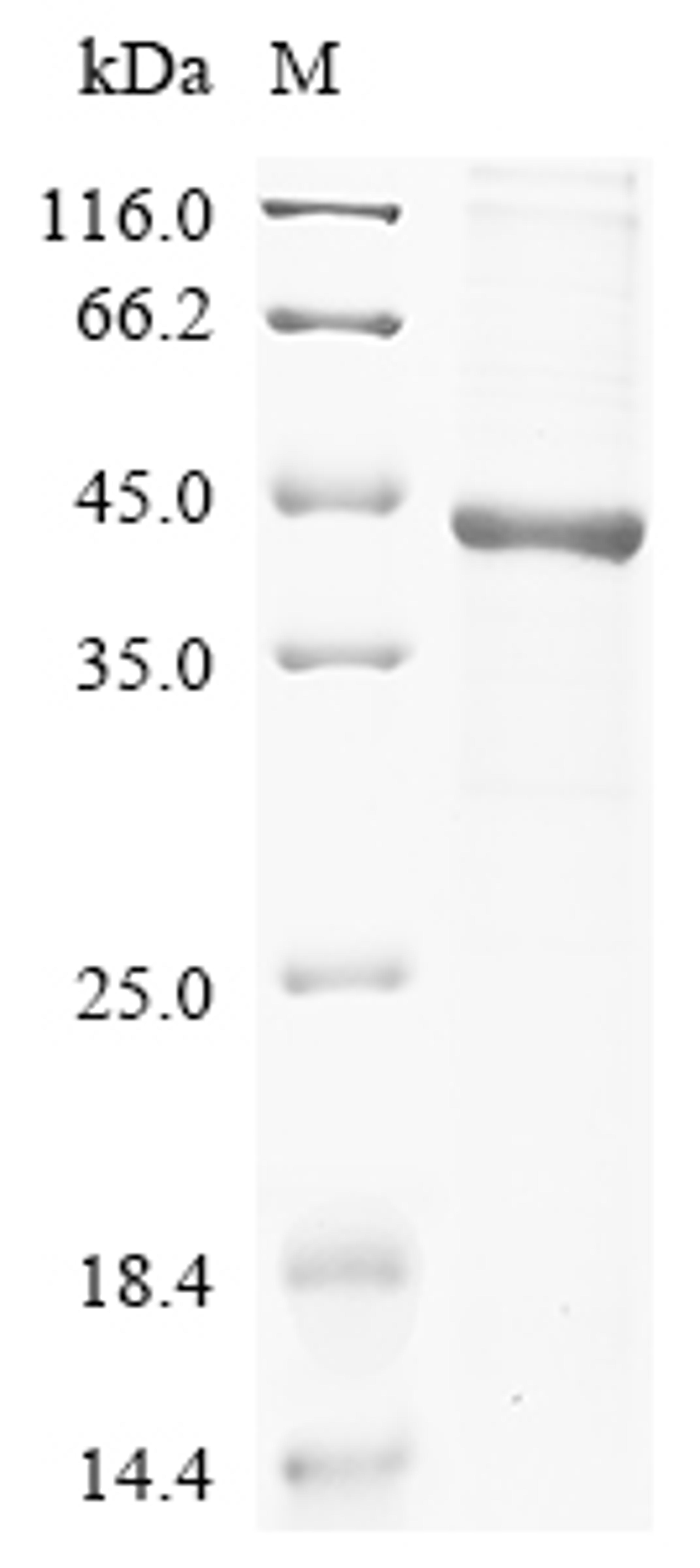 (Tris-Glycine gel) Discontinuous SDS-PAGE (reduced) with 5% enrichment gel and 15% separation gel.