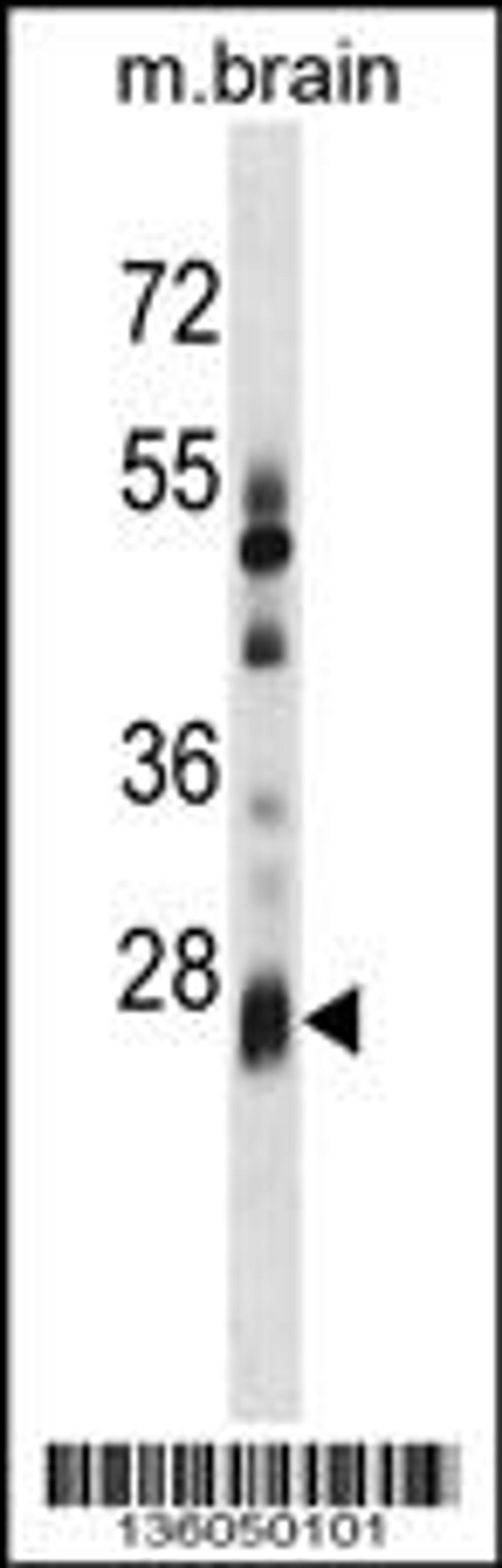 Western blot analysis in mouse brain tissue lysates (35ug/lane).