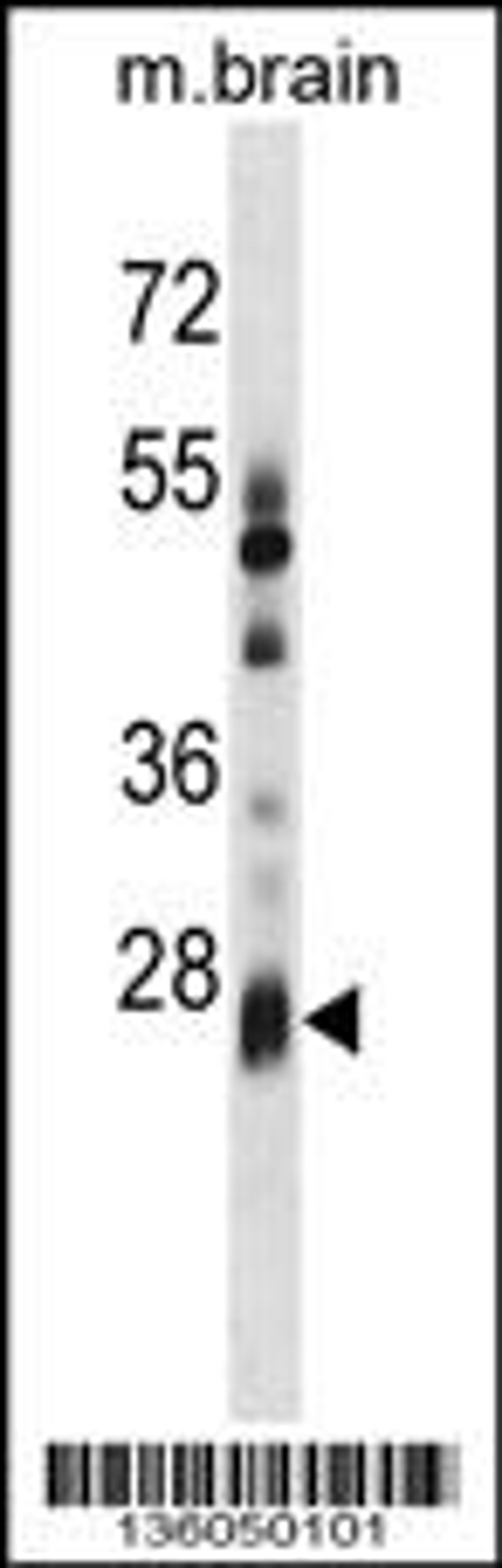 Western blot analysis in mouse brain tissue lysates (35ug/lane).