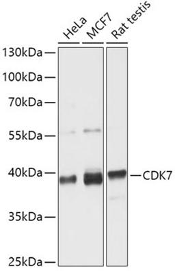 Western blot - CDK7 antibody (A12942)