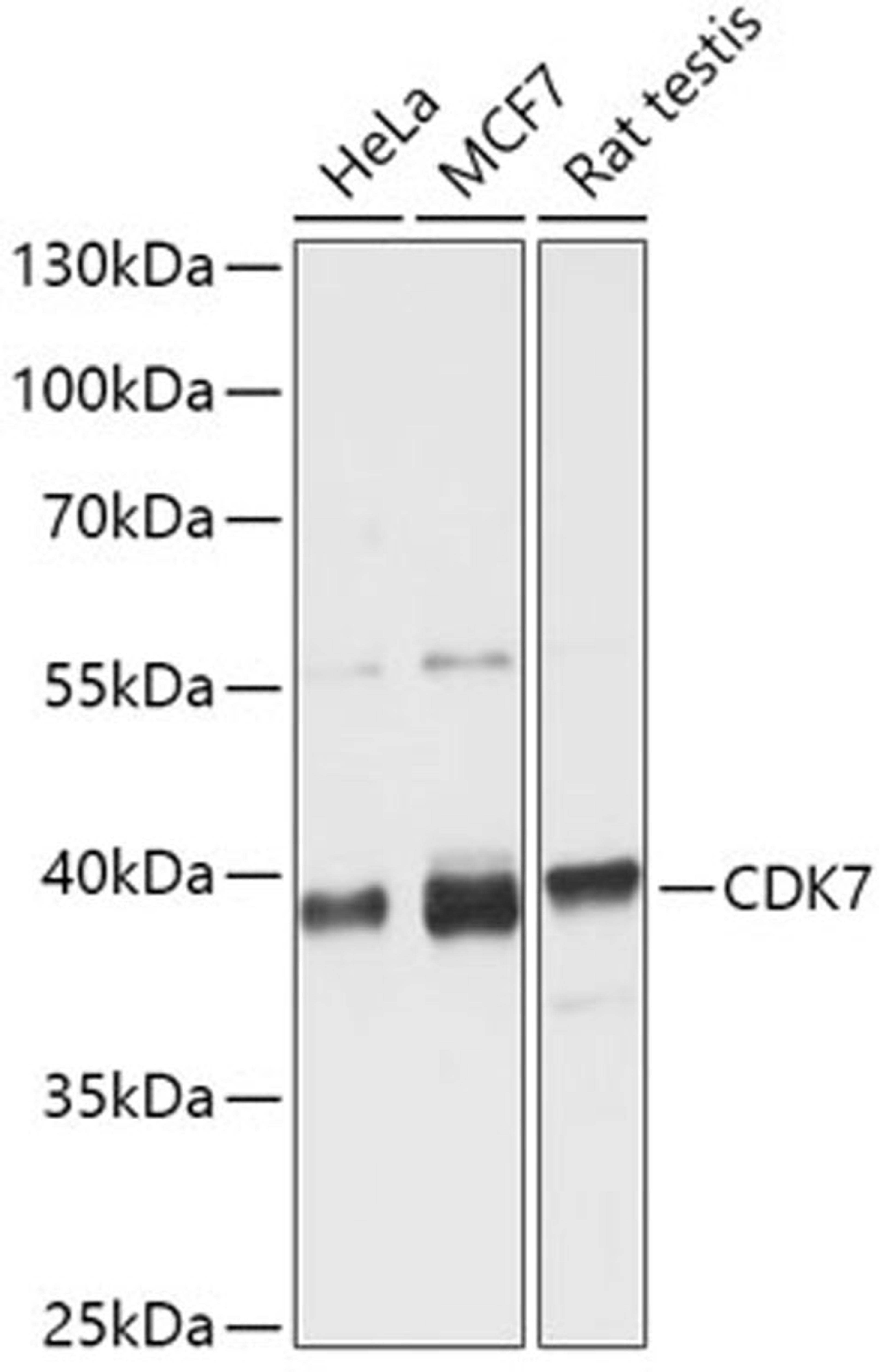 Western blot - CDK7 antibody (A12942)