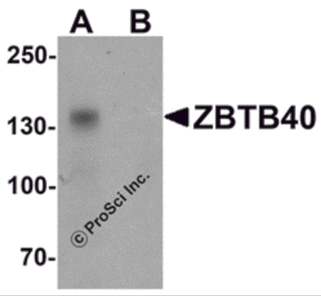 Western blot analysis of ZBTB40 in Raji cell lysate with ZBTB40 antibody at 0.5 μg/ml in (A) the absence and (B) the presence of blocking peptide.