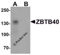 Western blot analysis of ZBTB40 in Raji cell lysate with ZBTB40 antibody at 0.5 μg/ml in (A) the absence and (B) the presence of blocking peptide.