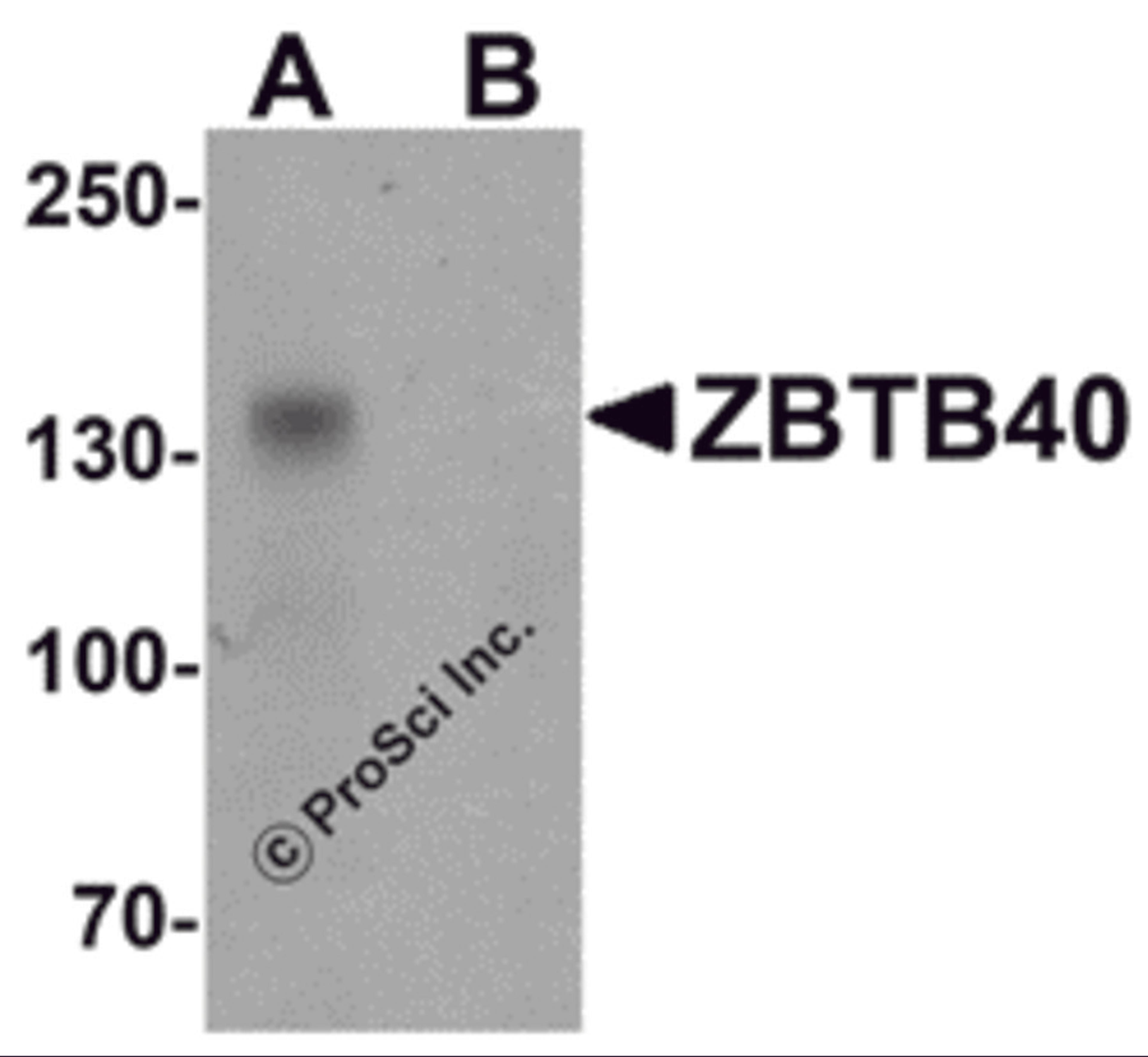 Western blot analysis of ZBTB40 in Raji cell lysate with ZBTB40 antibody at 0.5 μg/ml in (A) the absence and (B) the presence of blocking peptide.