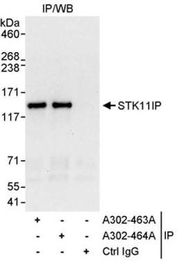 Detection of human STK11IP by western blot of immunoprecipitates.