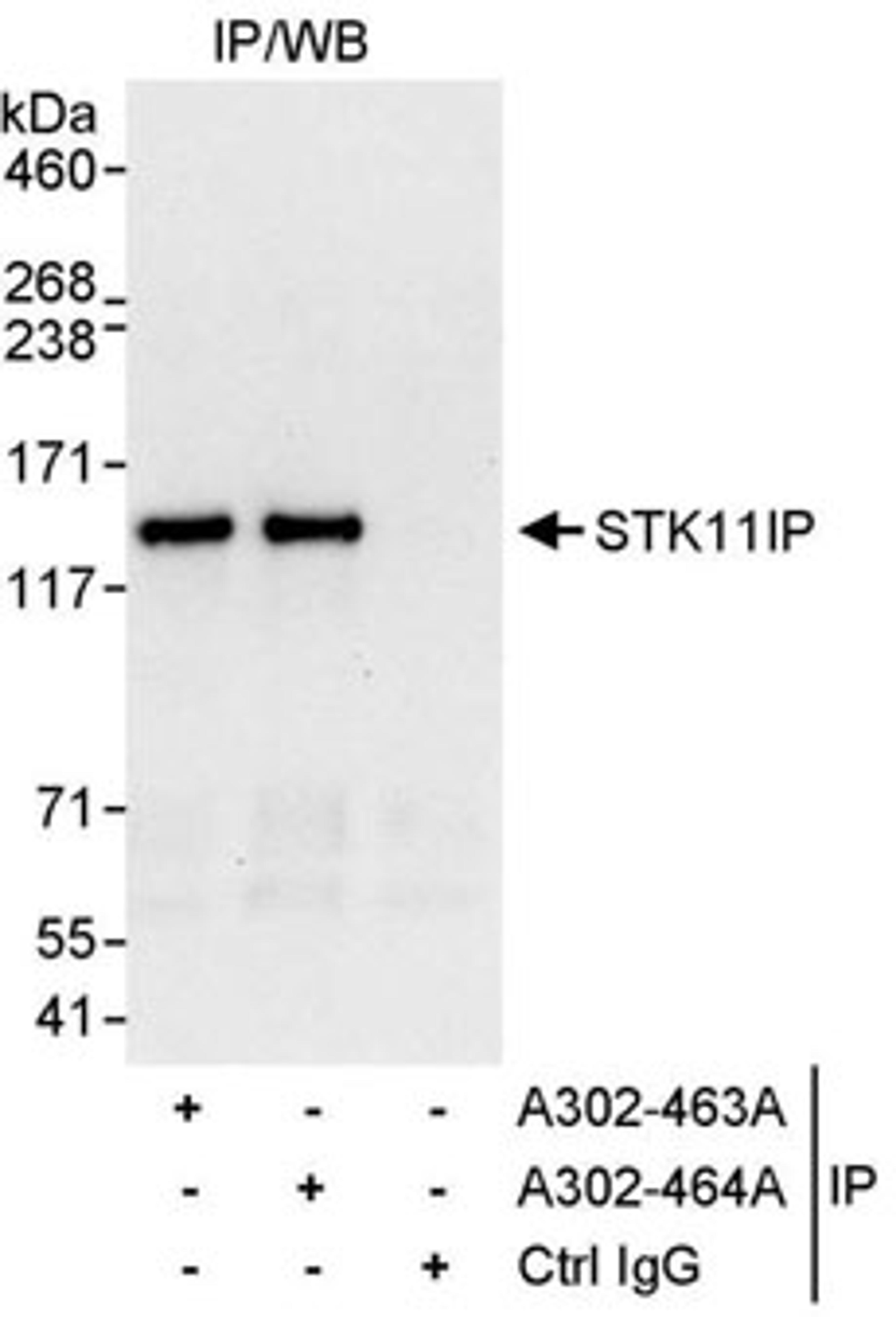 Detection of human STK11IP by western blot of immunoprecipitates.