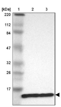 Western Blot: RPL30 Antibody [NBP1-82855] - Lane 1: Marker [kDa] 220, 112, 84, 47, 32, 26, 17<br/>Lane 2: Human cell line RT-4<br/>Lane 3: Human cell line U-251MG sp