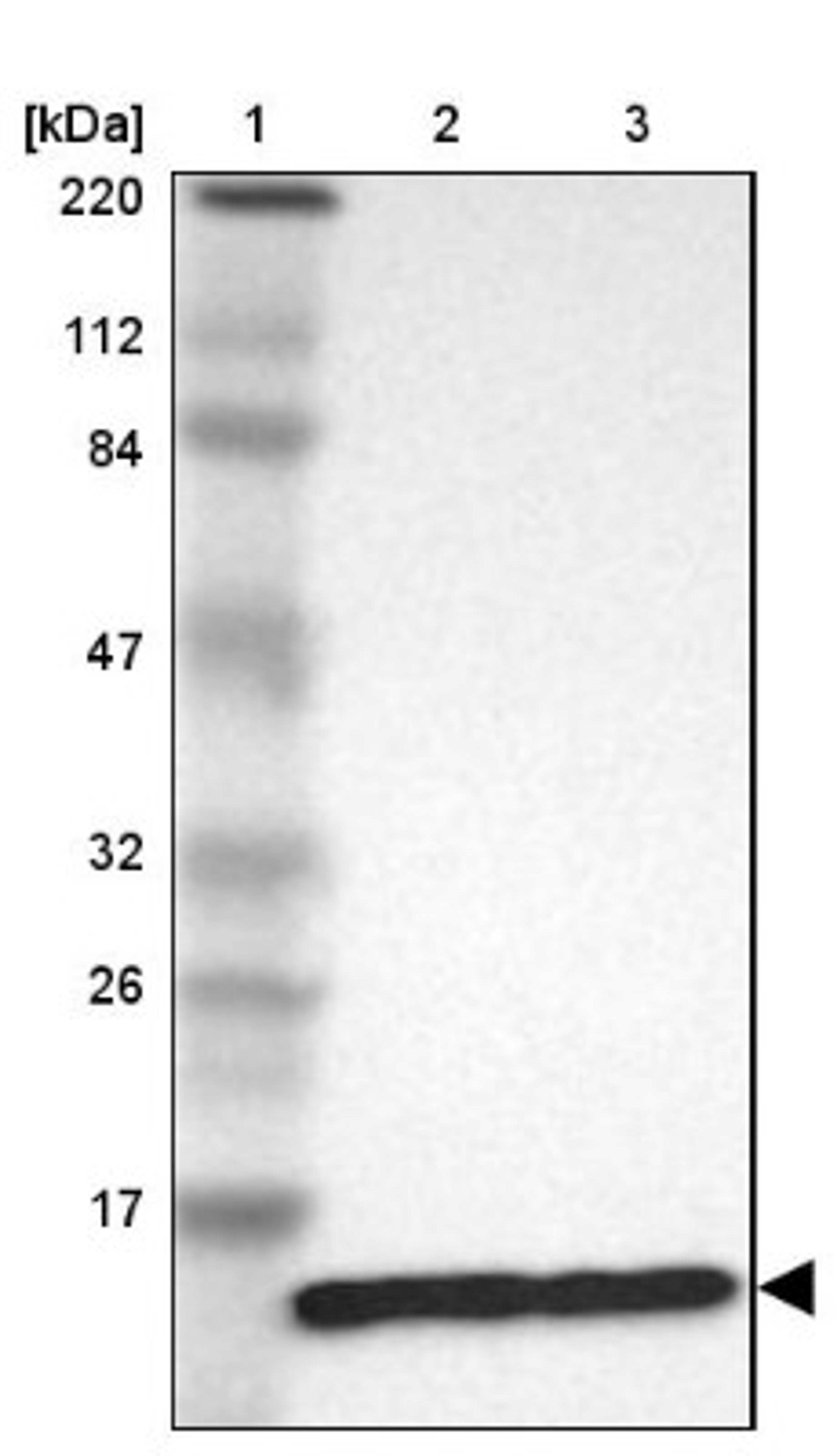 Western Blot: RPL30 Antibody [NBP1-82855] - Lane 1: Marker [kDa] 220, 112, 84, 47, 32, 26, 17<br/>Lane 2: Human cell line RT-4<br/>Lane 3: Human cell line U-251MG sp