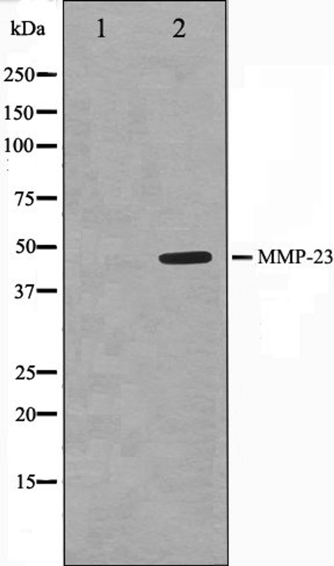 Western blot analysis of SK-OV3 cell lysate using MMP23 antibody