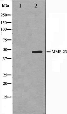 Western blot analysis of SK-OV3 cell lysate using MMP23 antibody