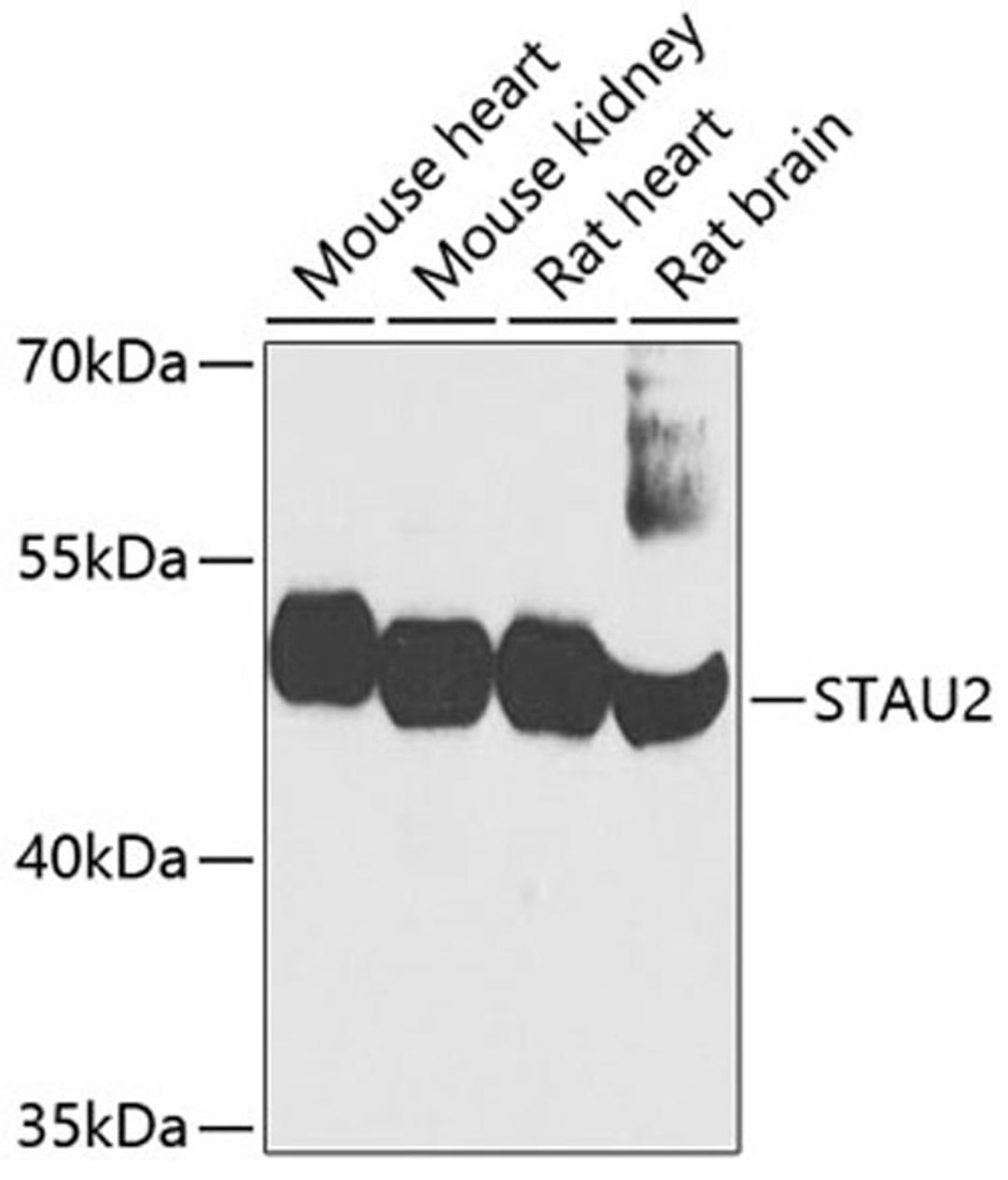 Western blot - STAU2 antibody (A3413)