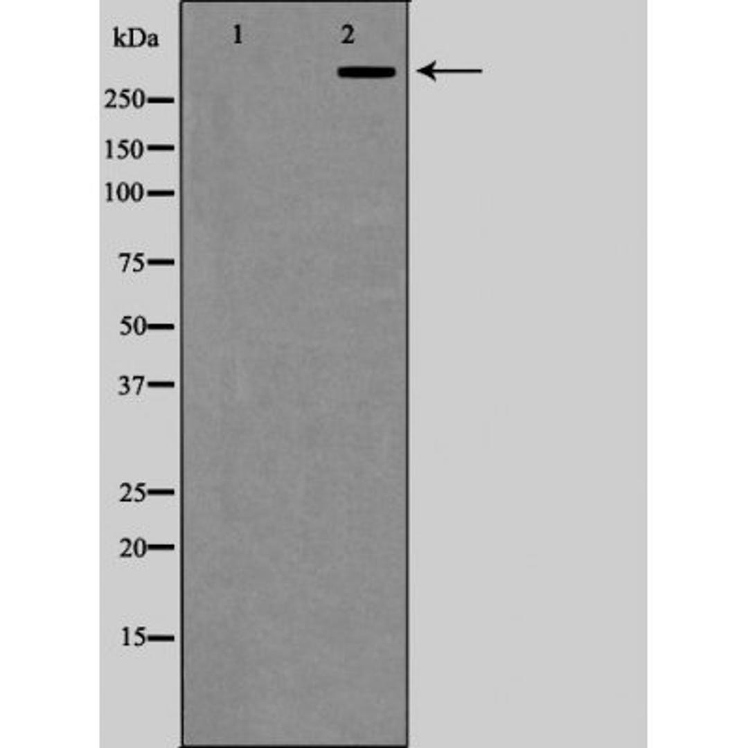 Western blot analysis of COLO205 cells using P300/CREBBP antibody