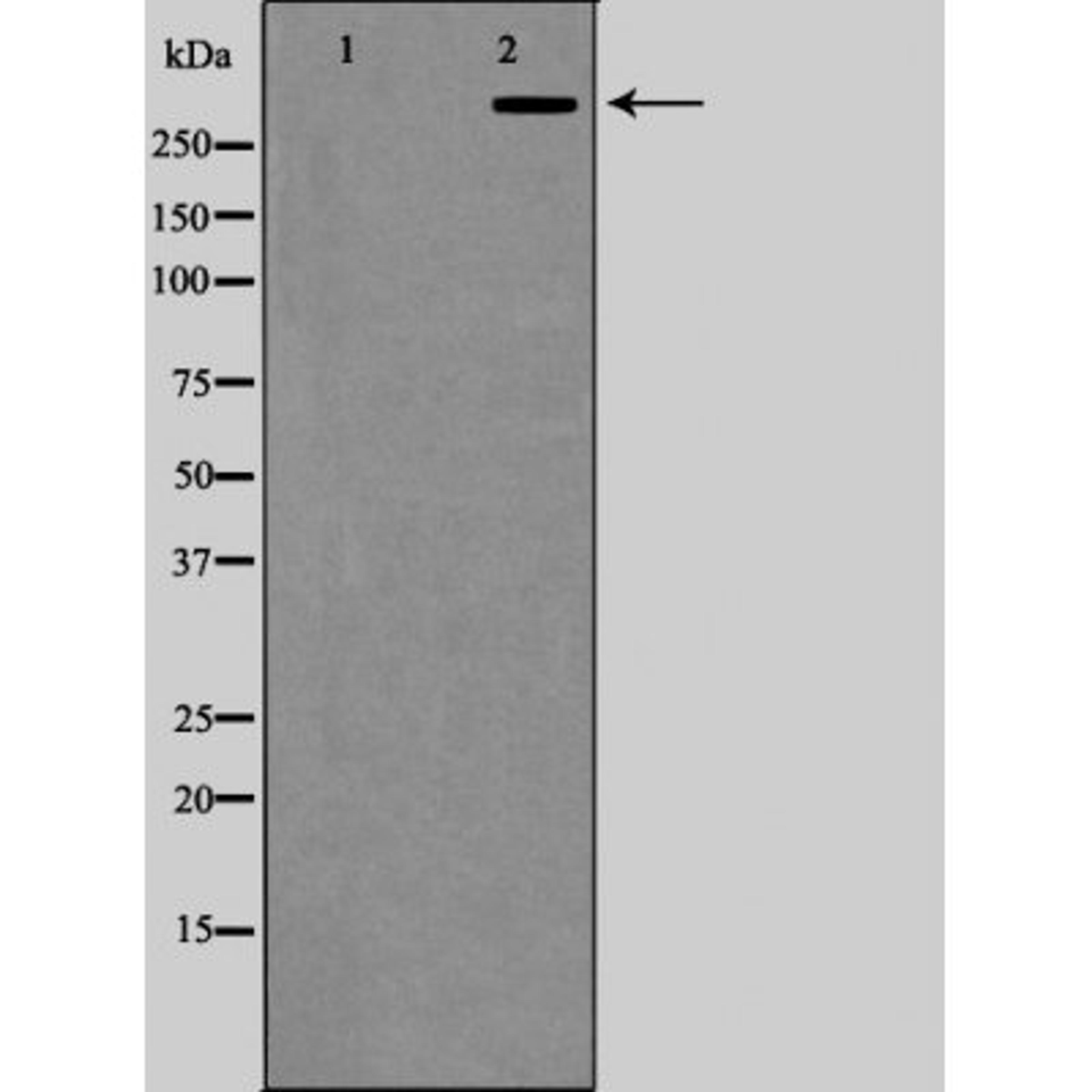 Western blot analysis of COLO205 cells using P300/CREBBP antibody