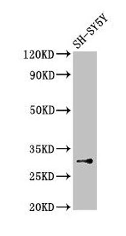 Western Blot. Positive WB detected in: SH-SY5Y whole cell lysate. All lanes: ISOC1 antibody at 3.5µg/ml. Secondary. Goat polyclonal to rabbit IgG at 1/50000 dilution. Predicted band size: 33 kDa. Observed band size: 33 kDa