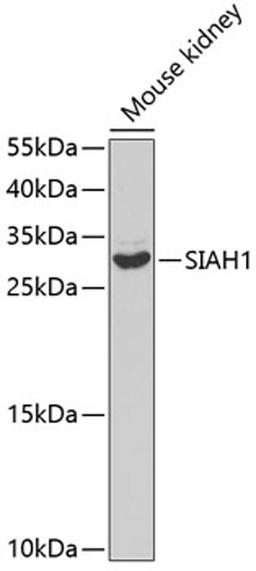 Western blot - SIAH1 antibody (A2494)