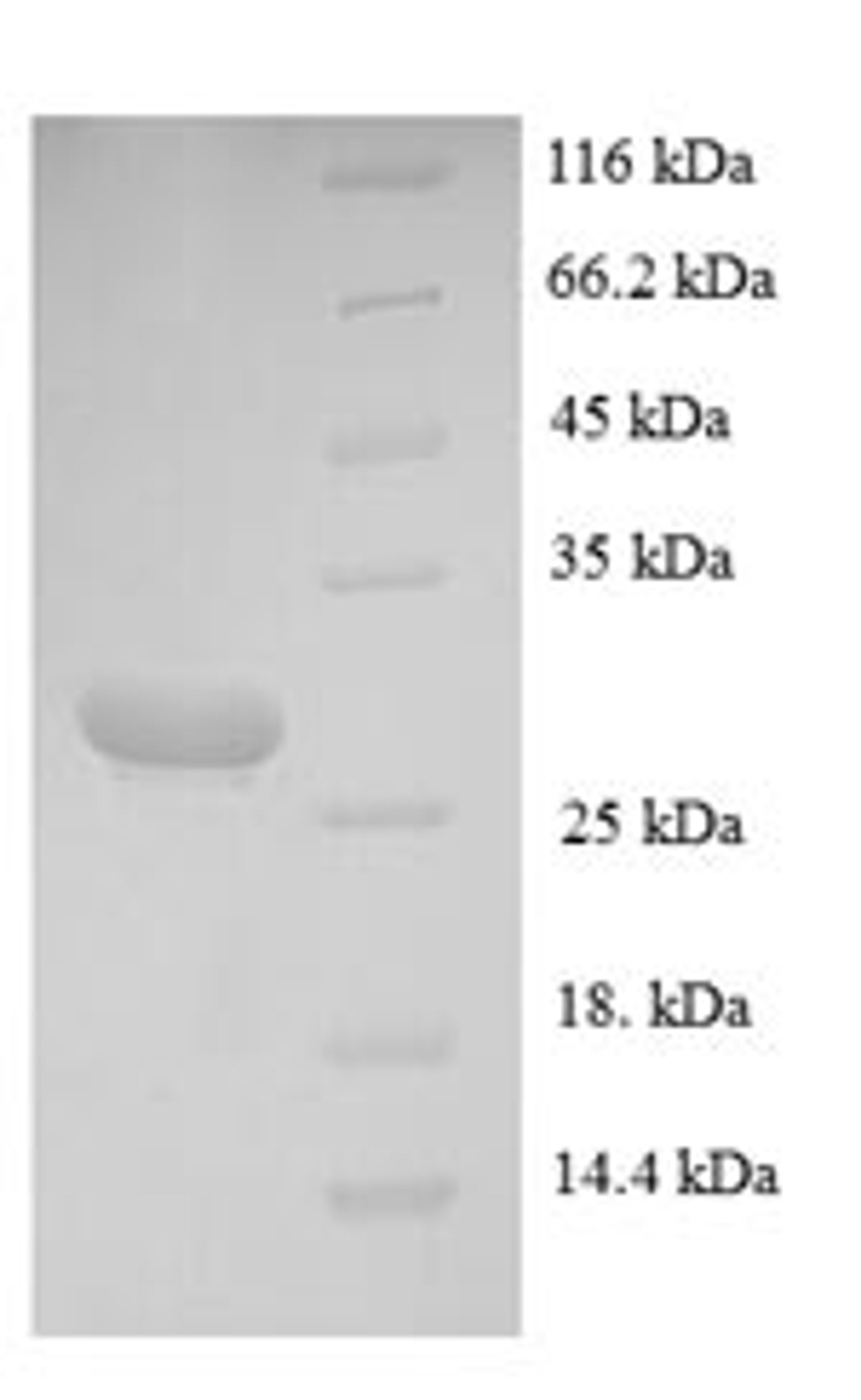 (Tris-Glycine gel) Discontinuous SDS-PAGE (reduced) with 5% enrichment gel and 15% separation gel.