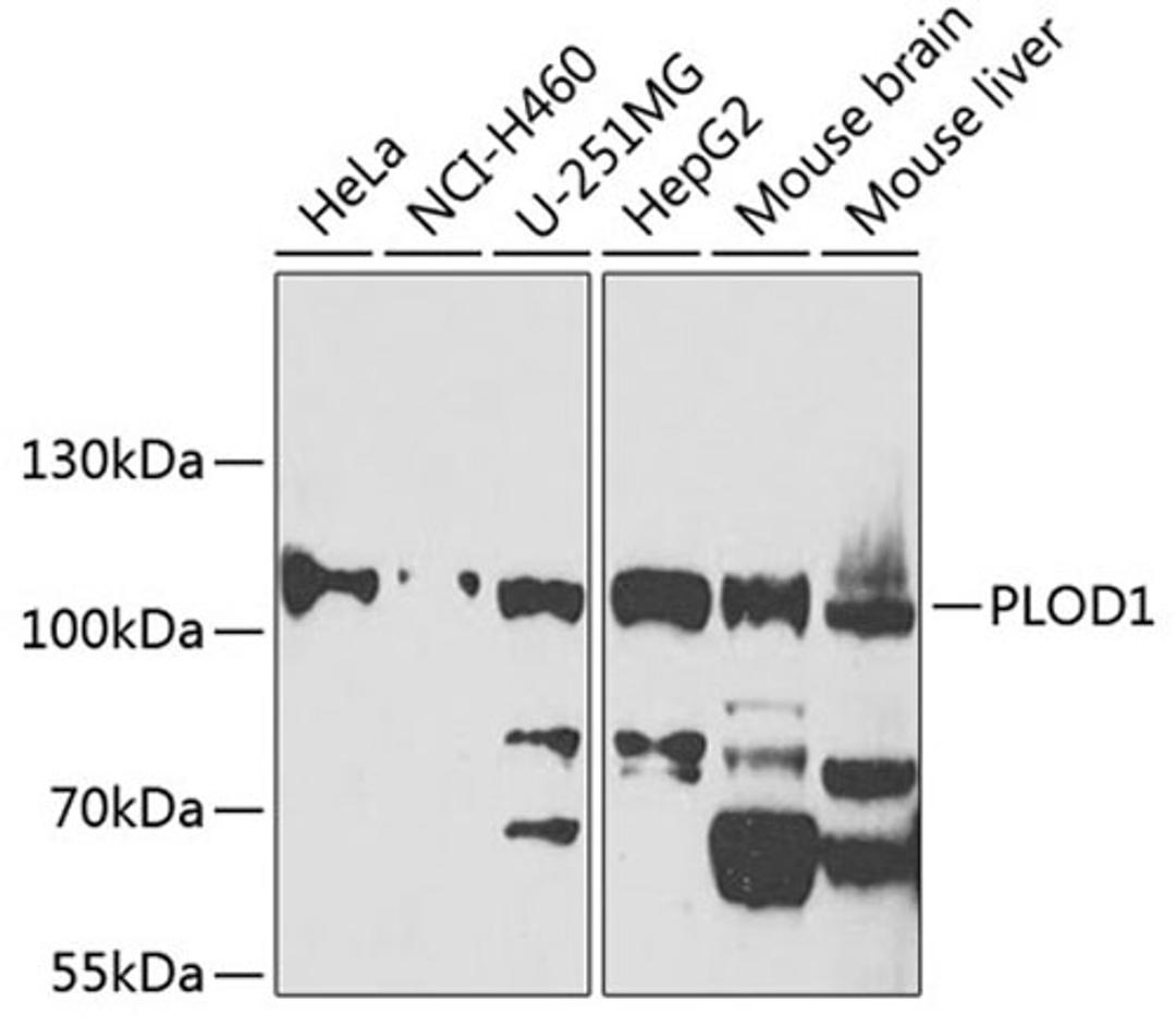 Western blot - PLOD1 antibody (A7919)