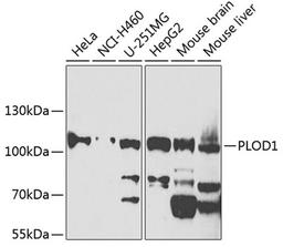 Western blot - PLOD1 antibody (A7919)