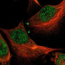 Immunocytochemistry/Immunofluorescence: IRF4 Antibody [NBP1-82813] - Staining of human cell line U-251MG shows positivity in nucleus but not nucleoli & cytoplasm.