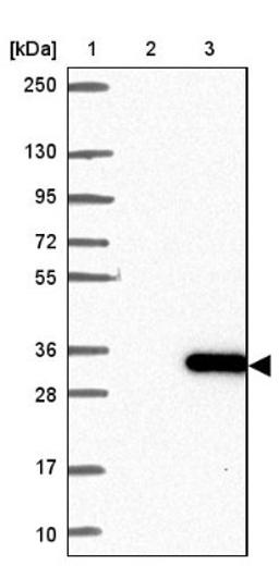 Western Blot: STARD6 Antibody [NBP2-13394] - Lane 1: Marker [kDa] 250, 130, 95, 72, 55, 36, 28, 17, 10<br/>Lane 2: Negative control (vector only transfected HEK293T lysate)<br/>Lane 3: Over-expression lysate (Co-expressed with a C-terminal myc-DDK tag (~3.1 kDa) in mammalian HEK293T cells, LY408374)