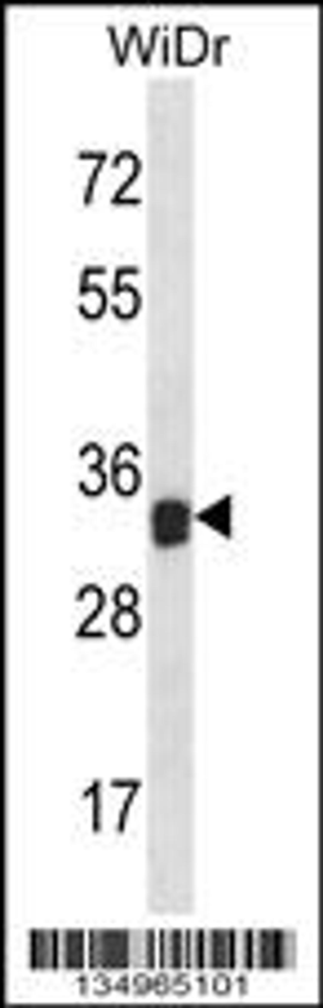 Western blot analysis in WiDr cell line lysates (35ug/lane).