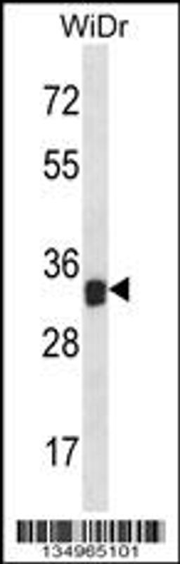 Western blot analysis in WiDr cell line lysates (35ug/lane).