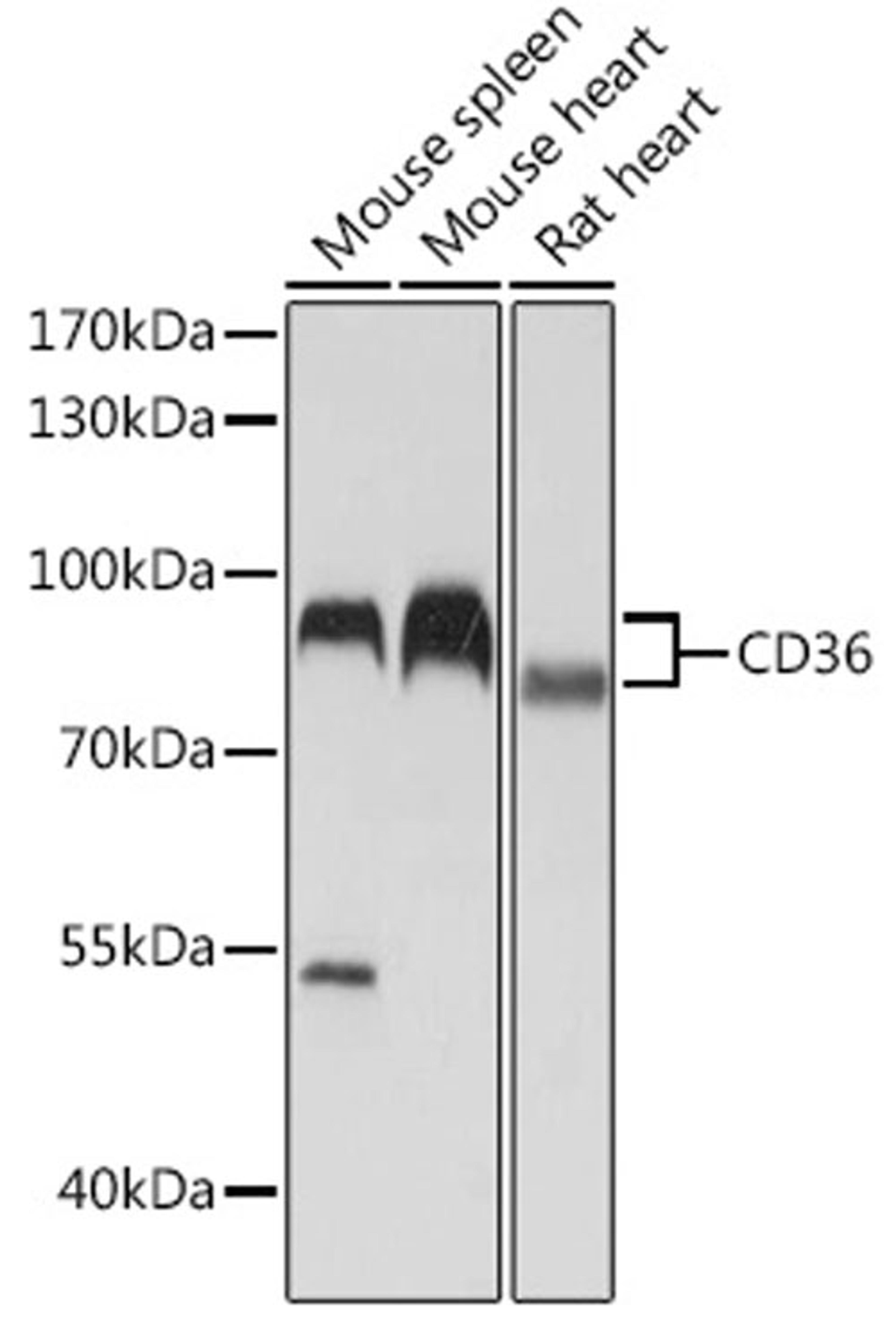 Western blot - CD36 antibody (A5792)