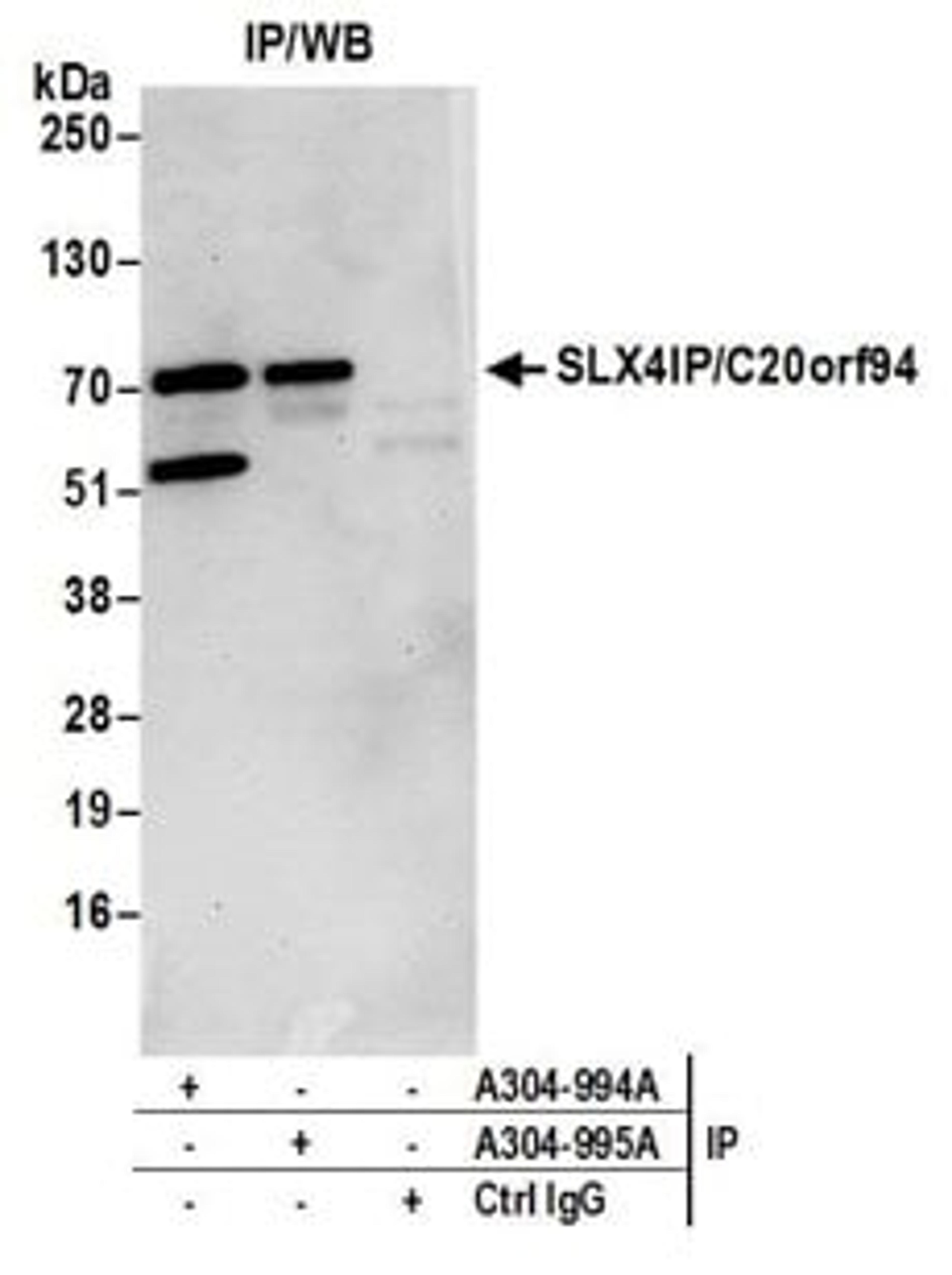 Detection of human SLX4IP/C20orf94 by western blot of immunoprecipitates.