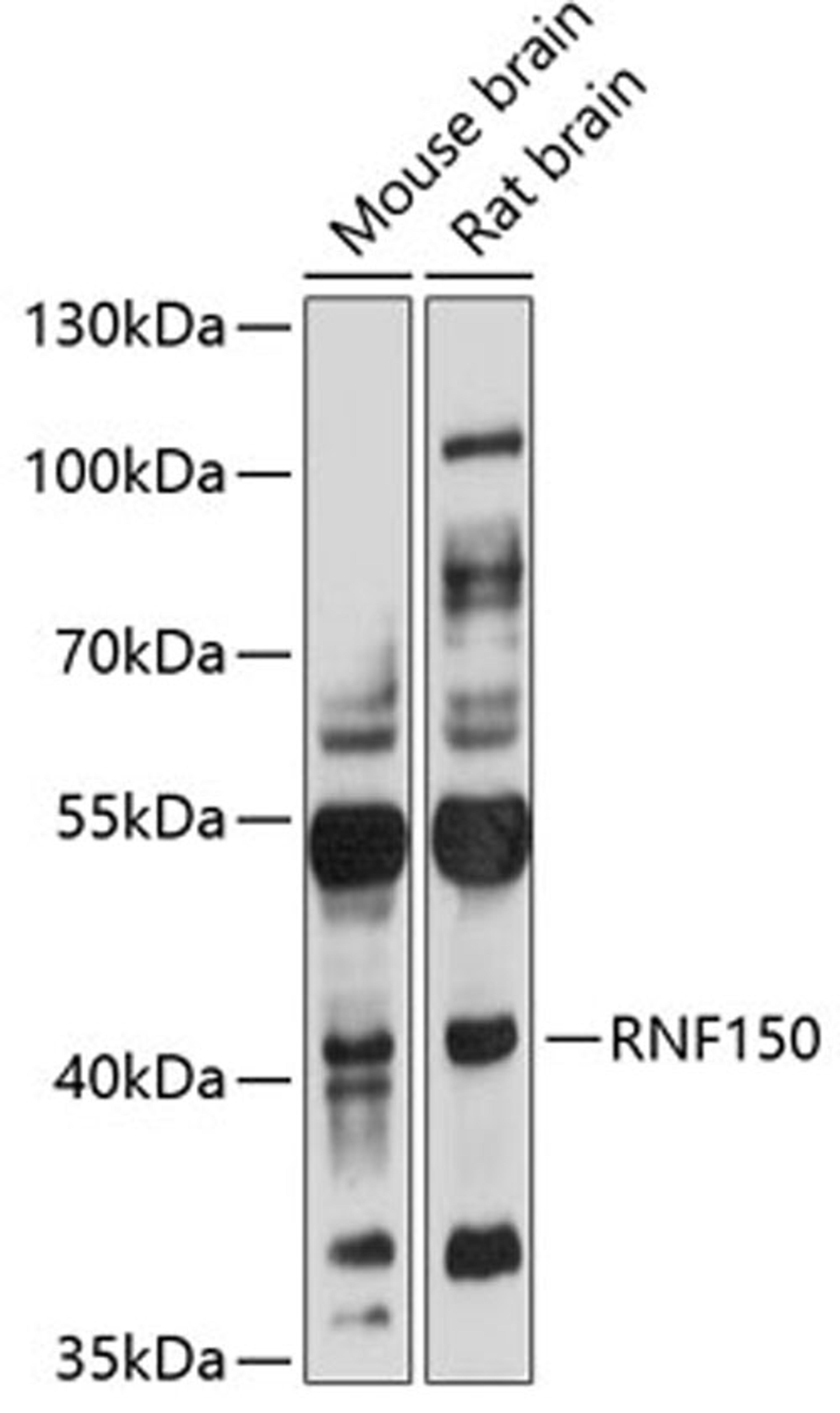 Western blot - RNF150 antibody (A3472)