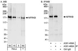 Detection of human NFRKB by western blot and immunoprecipitation.