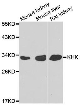 Western blot analysis of extracts of various cell lines using KHK antibody