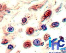 Immunohistochemistry-Paraffin: Neuropilin-1 Antibody [NBP2-24617] -  Formalin-fixed, paraffin-embedded human cervix tissue stained with NBP2-24617 at 5 ug/ml.