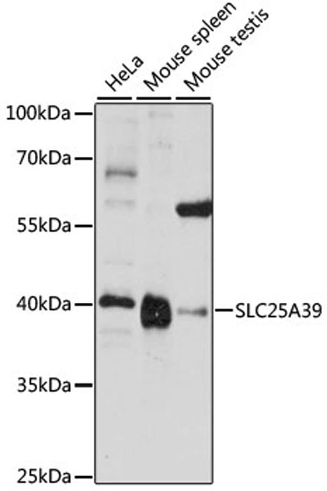 Western blot - SLC25A39 antibody (A15450)