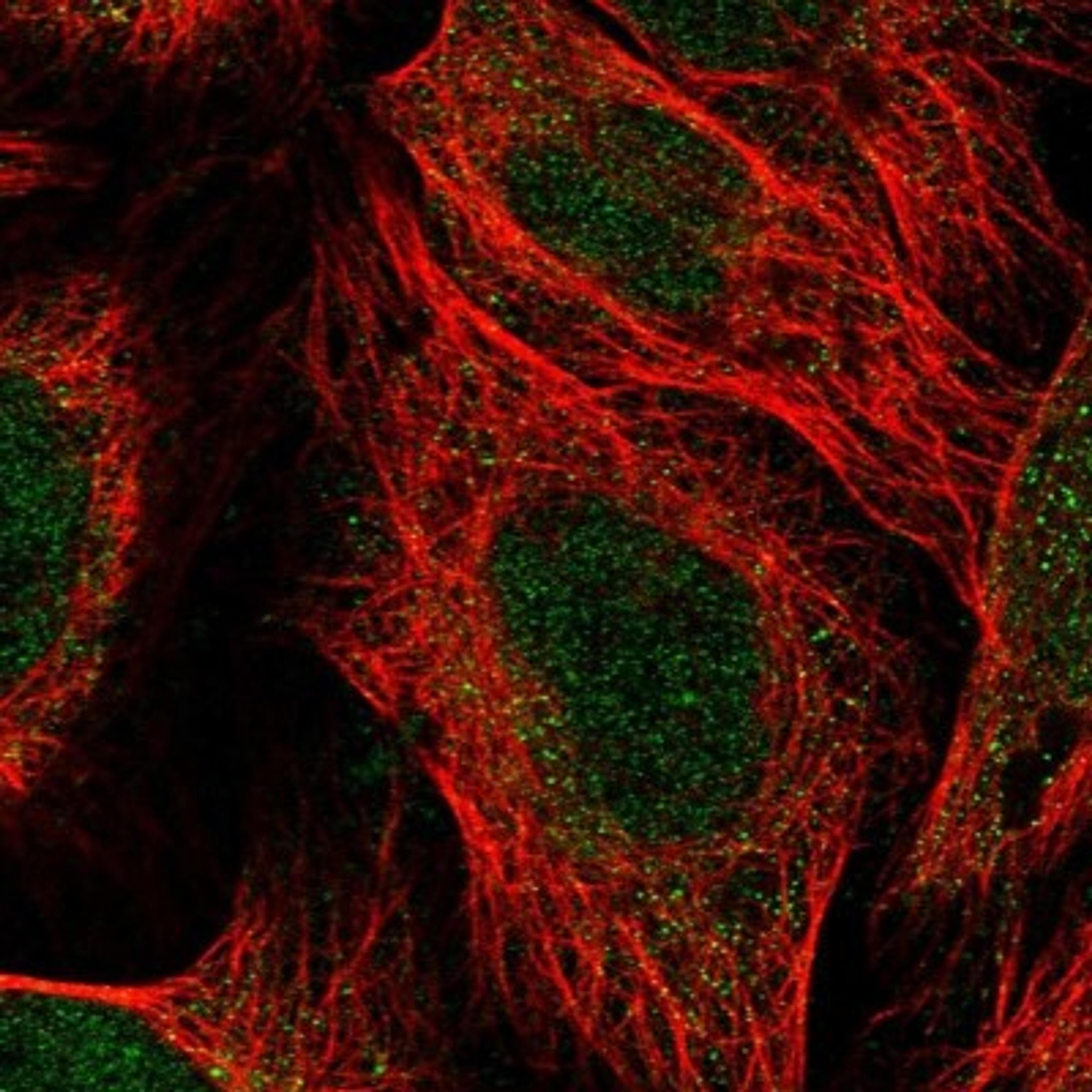 Immunocytochemistry/Immunofluorescence: SMCR7 Antibody [NBP1-81165] - Staining of human cell line U-2 OS shows positivity in nucleus & cytoplasm.