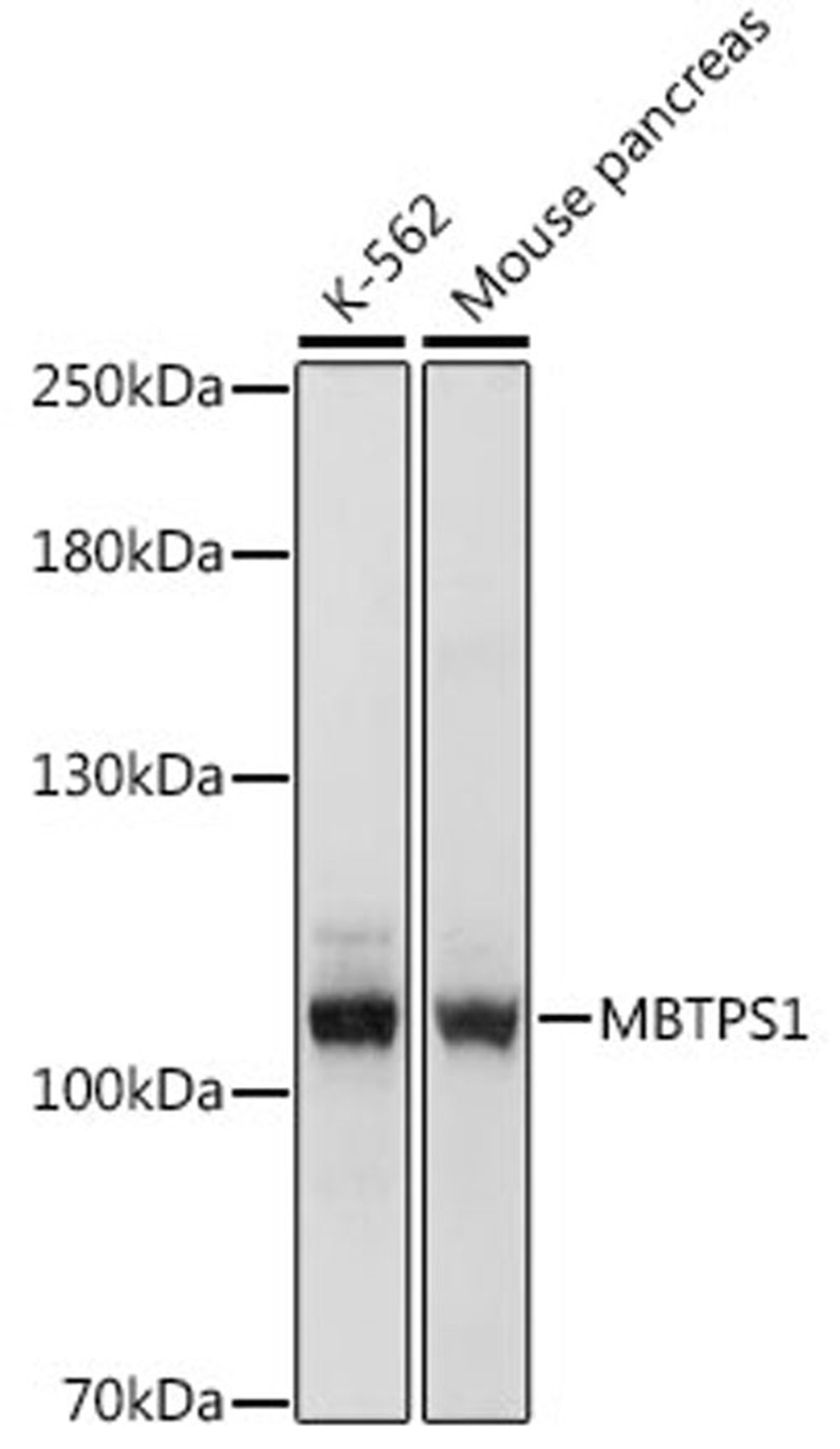 Western blot - MBTPS1 antibody (A16243)