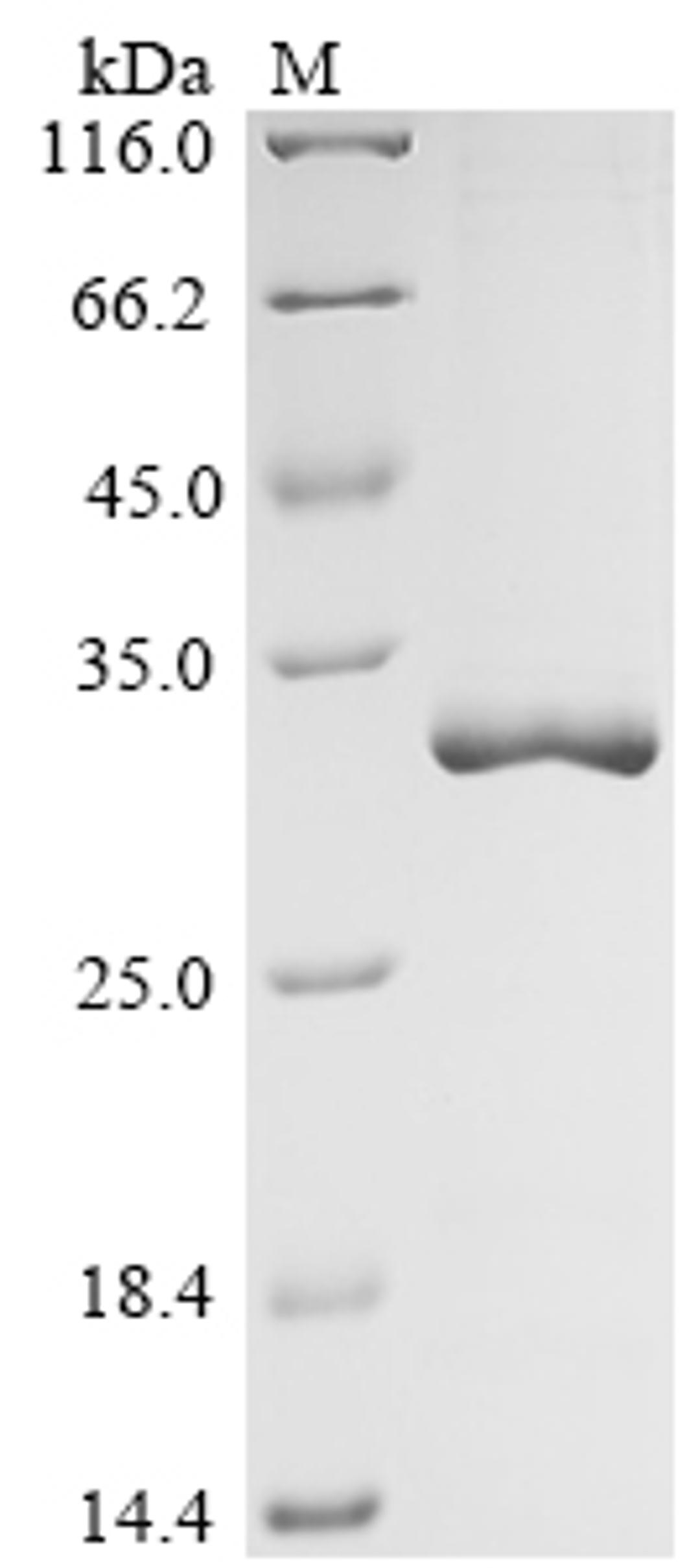 (Tris-Glycine gel) Discontinuous SDS-PAGE (reduced) with 5% enrichment gel and 15% separation gel.
