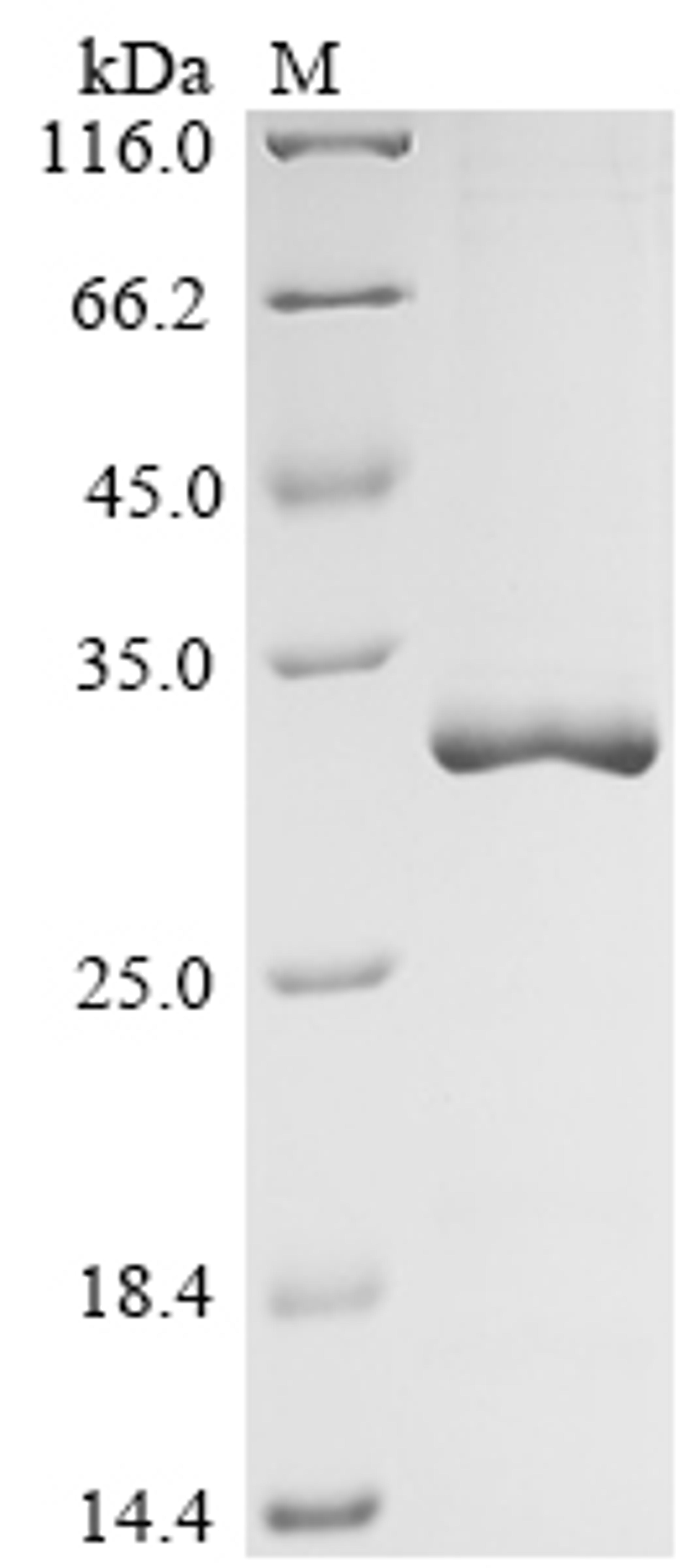 (Tris-Glycine gel) Discontinuous SDS-PAGE (reduced) with 5% enrichment gel and 15% separation gel.